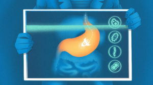 Illustration of startup rocket in stomach x-ray.