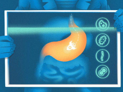 Illustration of startup rocket in stomach x-ray.